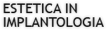 ESTETICA IN IMPLANTOLOGIA 